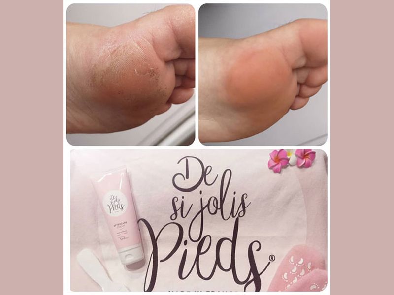 Soin des pieds Gauchy